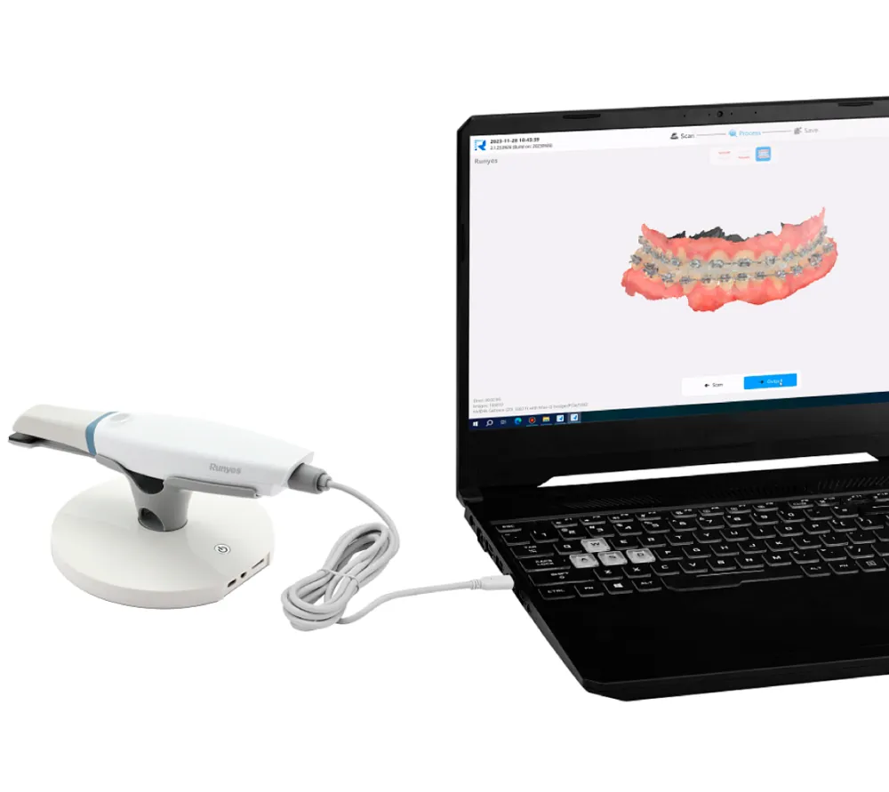 runyes ios-11 интраоральный 3d сканер  3