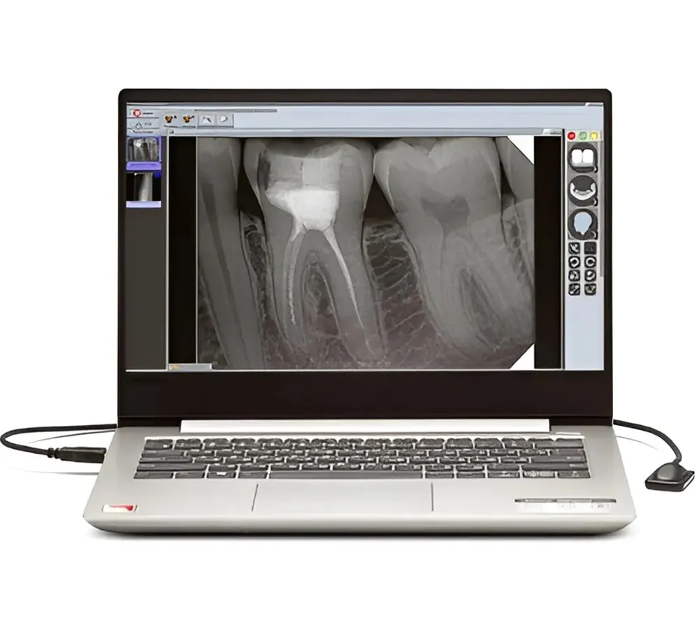 New Life Radiology Mercury DIGISENS цифровой интраоральный радиовизиограф, 20 микрон  3