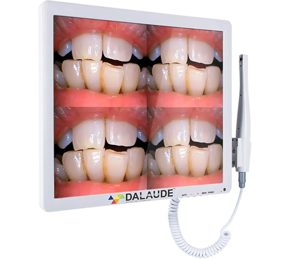 dalaude da-200 система с интегрированной интраоральной камерой  3