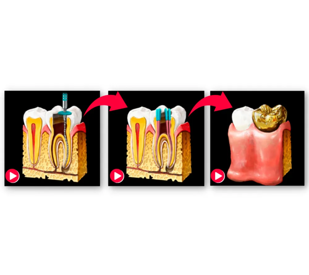 Vatech EzSensor Classic цифровой интраоральный радиовизиограф  5