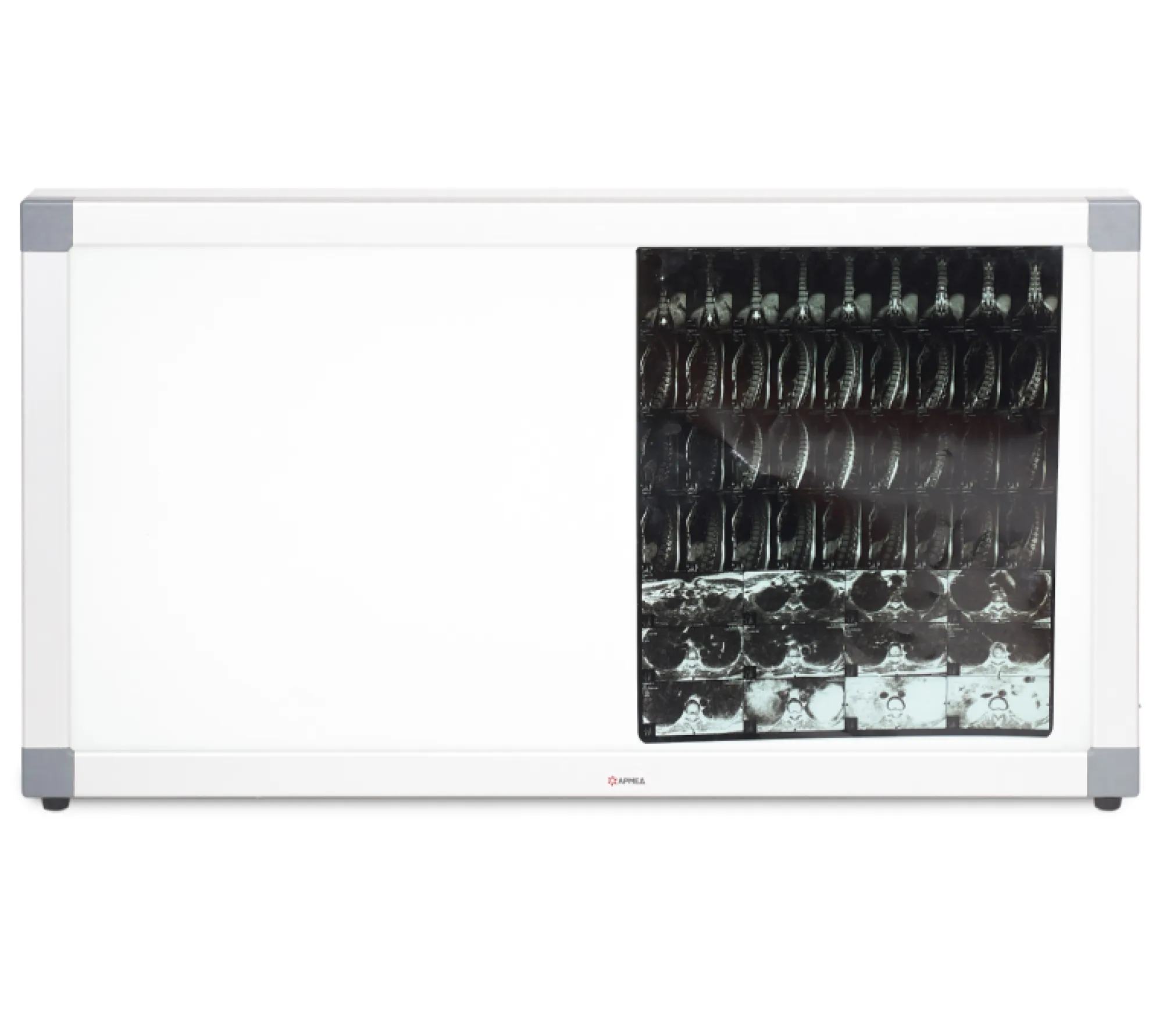 Армед Armed 2-кадровый негатоскоп общего назначения  4