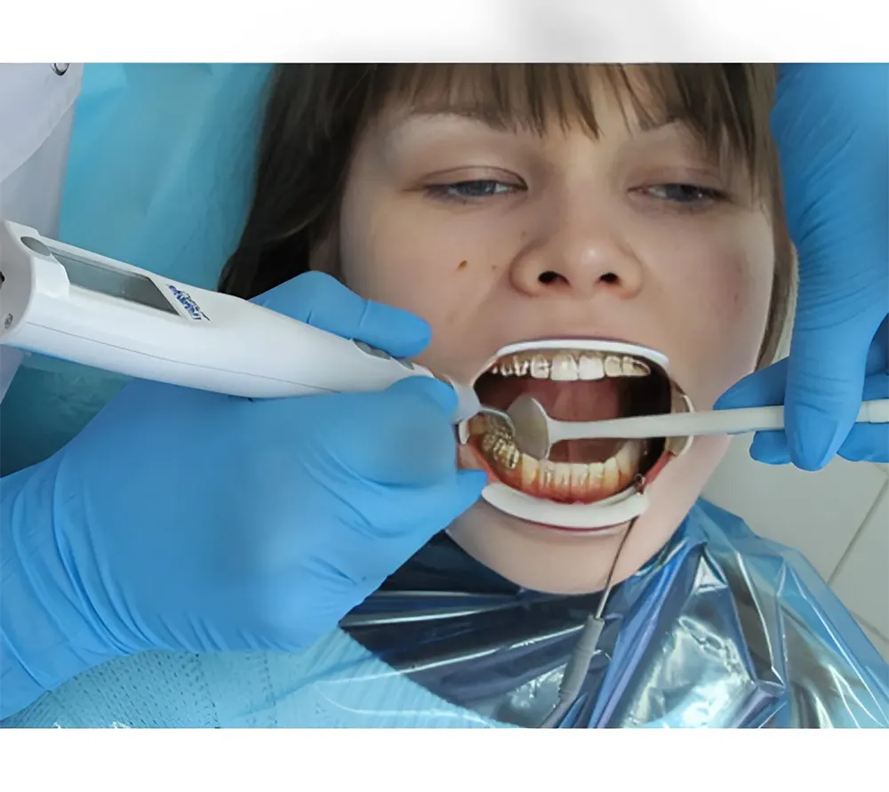 geosoft dent pulpest l пульп-тестер эод с подсветкой  2