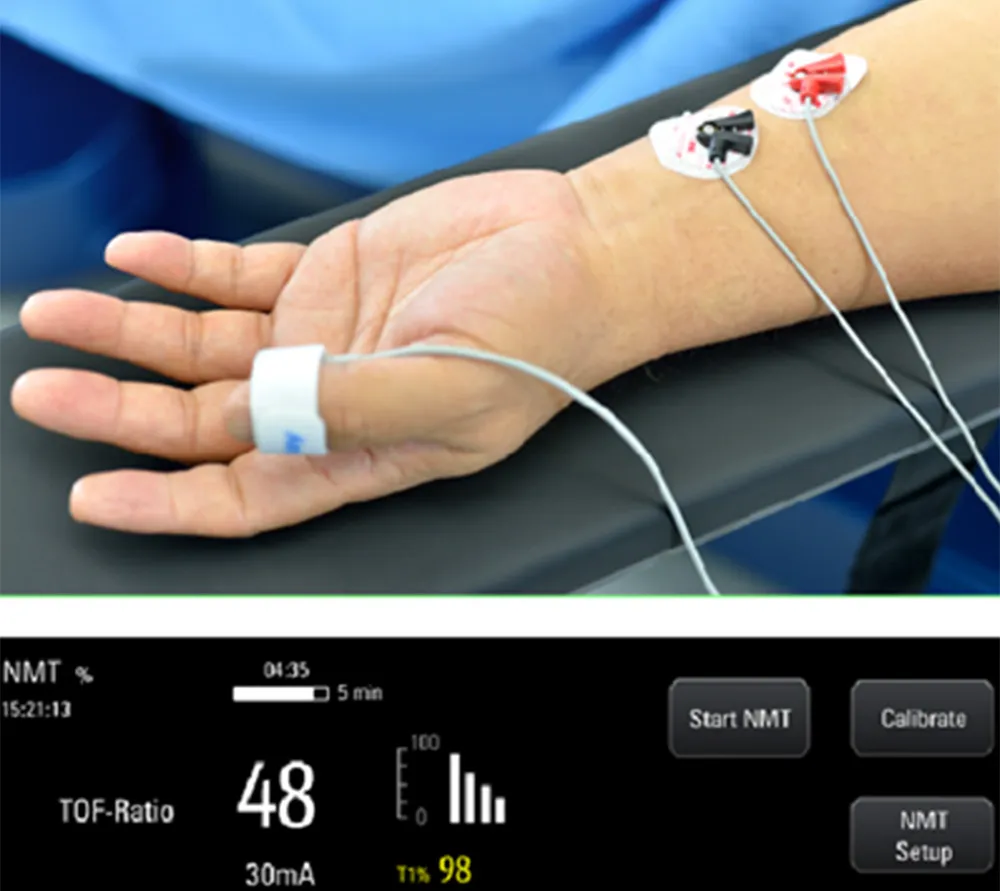 Mindray A7 наркозно-дыхательные аппараты  4