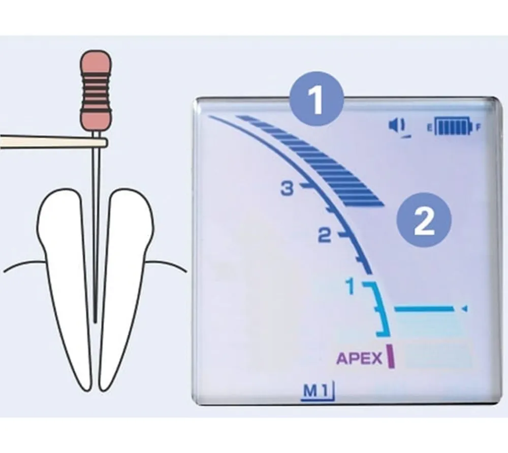 j.morita dentaport zx rcm-ex стоматологический аппарат: модуль апекслокатора  7