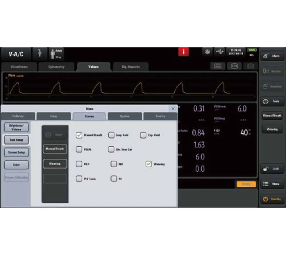 Mindray SV800 аппарат ИВЛ  3