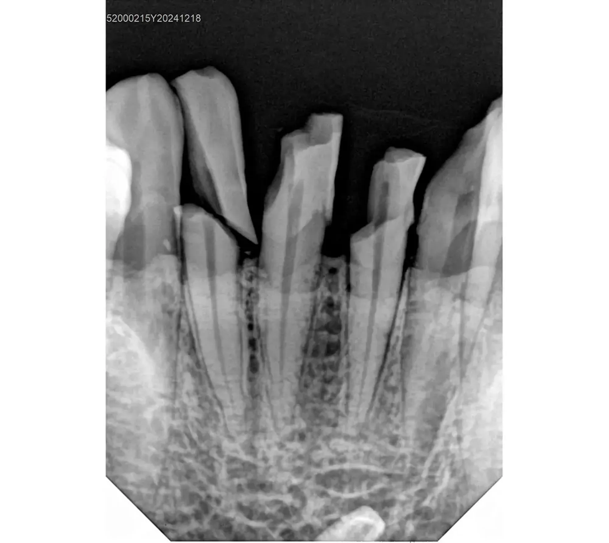 Handy HDR-380 цифровой радиовизиограф  6