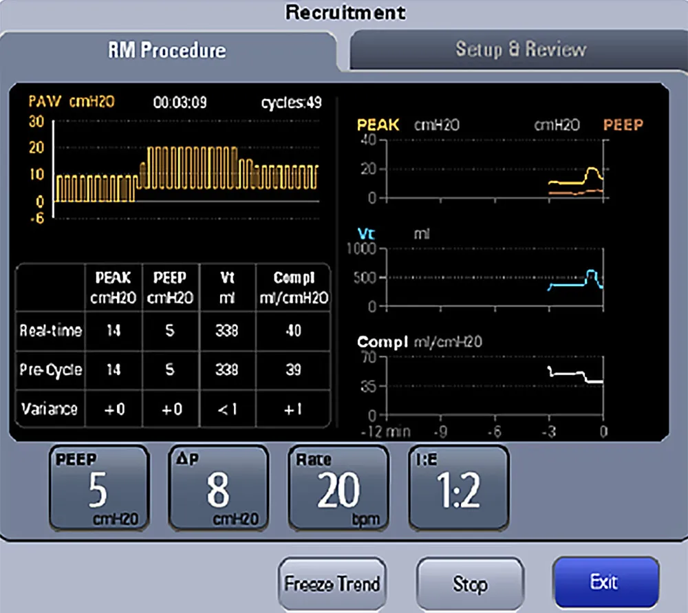 Mindray A7 наркозно-дыхательные аппараты  5