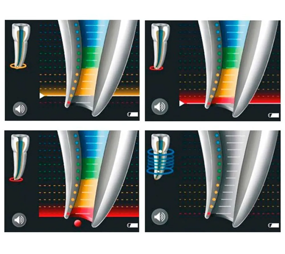 vdw raypex 6 электронно-цифровой апекслокатор 6-го поколения  5