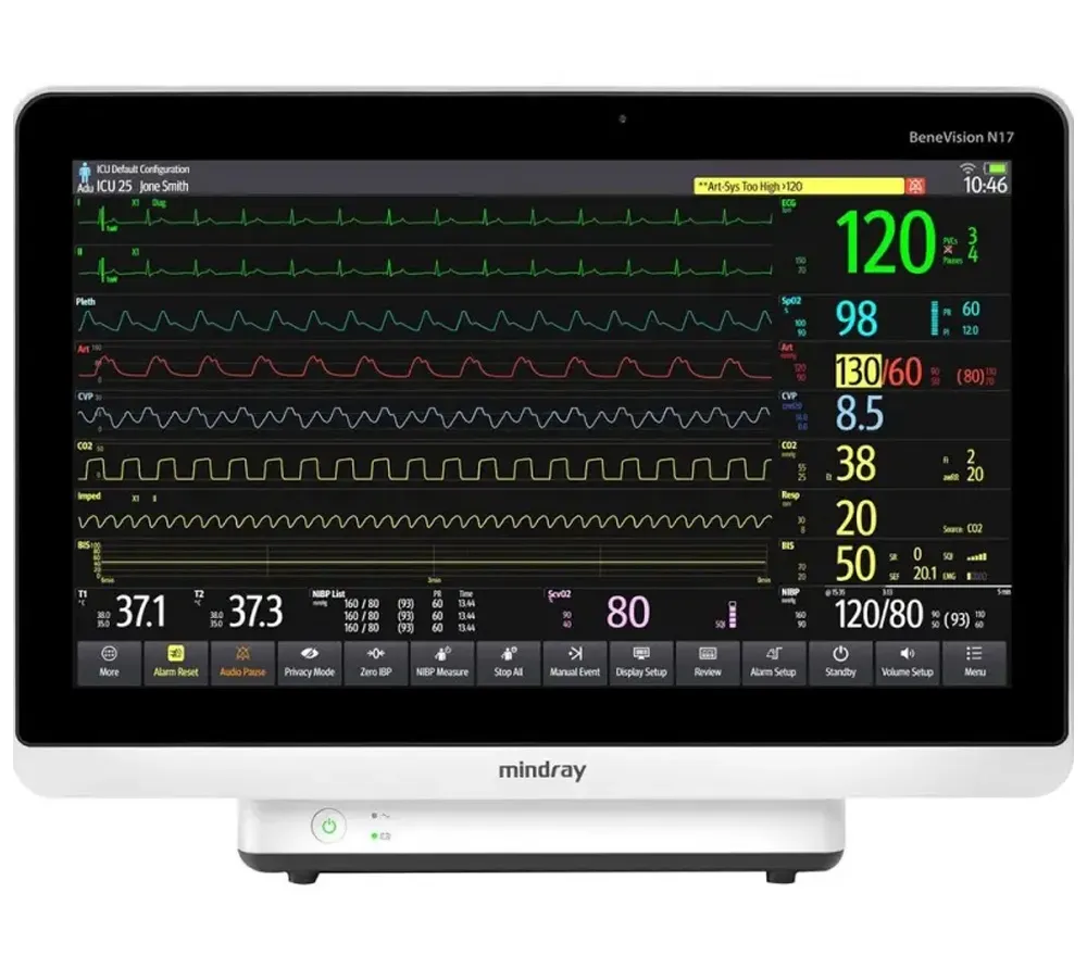 Mindray BeneVision N17 монитор пациента
