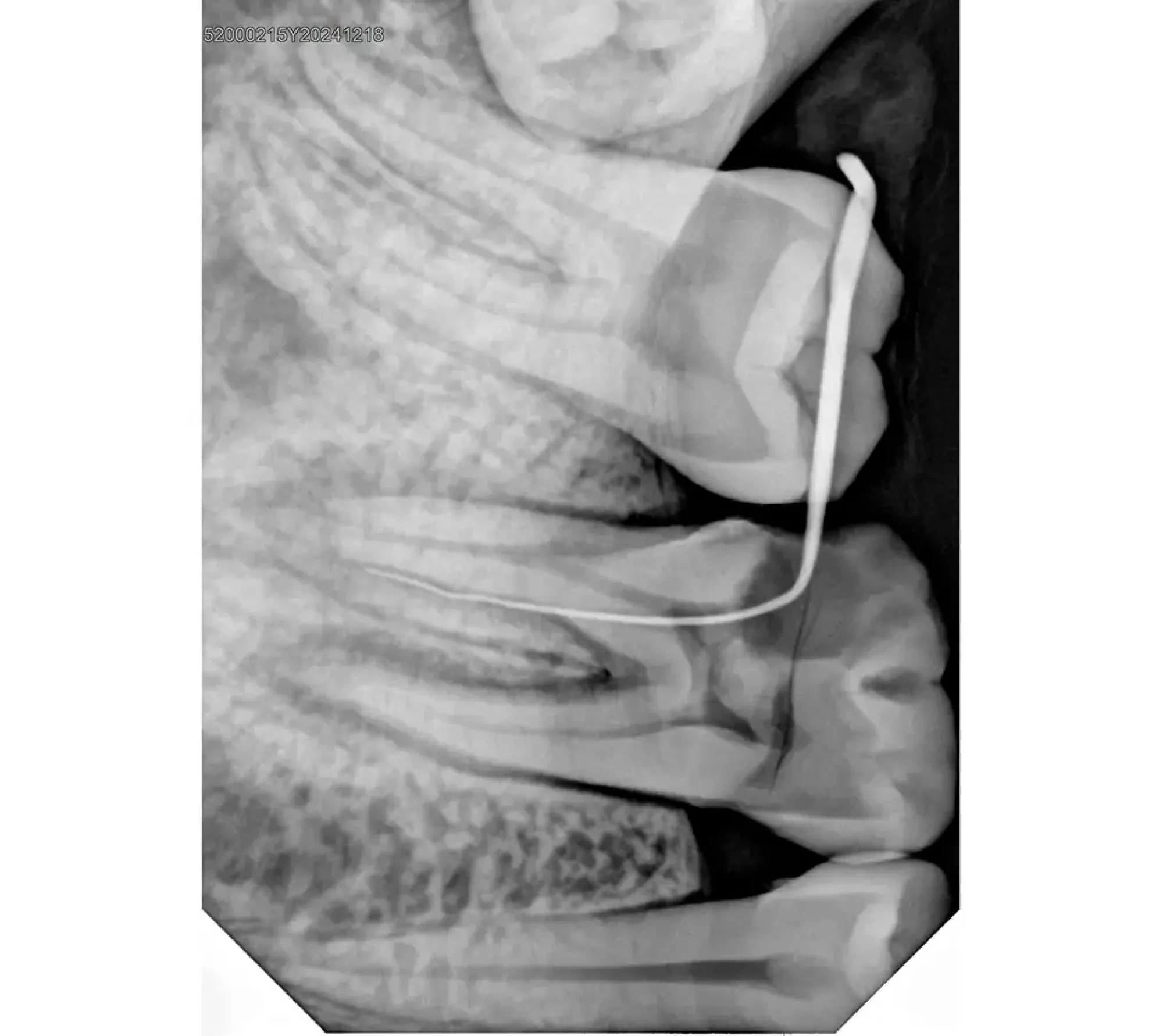 Handy HDR-380 цифровой радиовизиограф  7