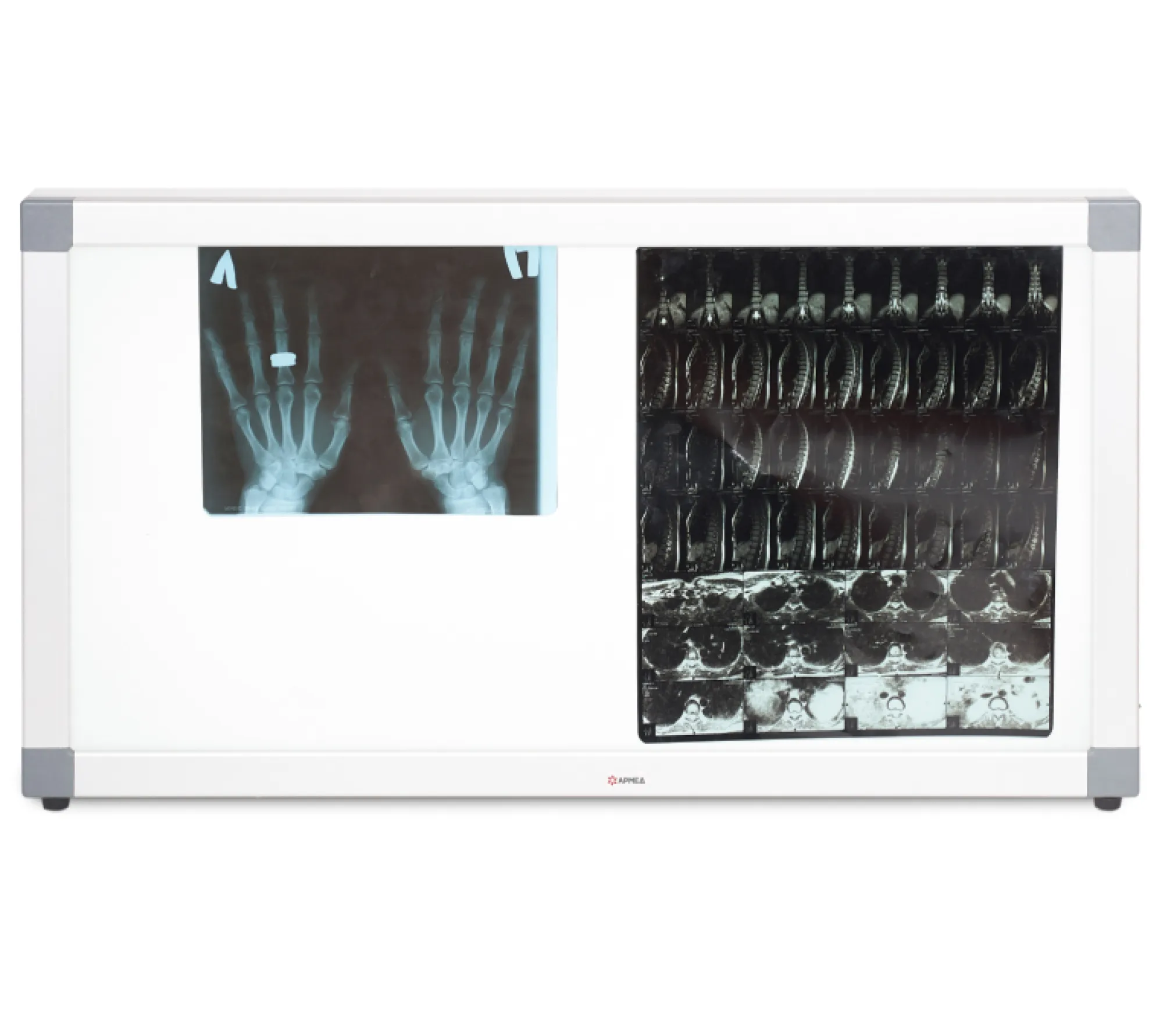 Армед Armed 2-кадровый негатоскоп общего назначения  5