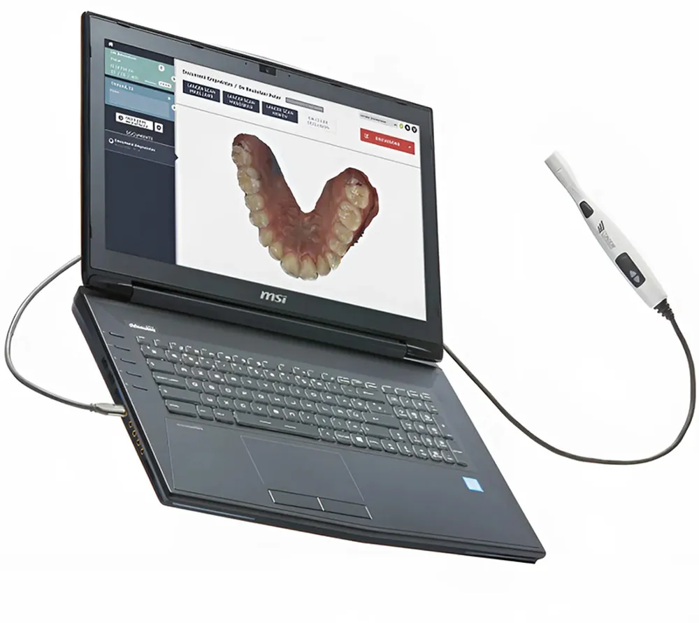 condor интраоральный сканер, ноутбук в комплекте