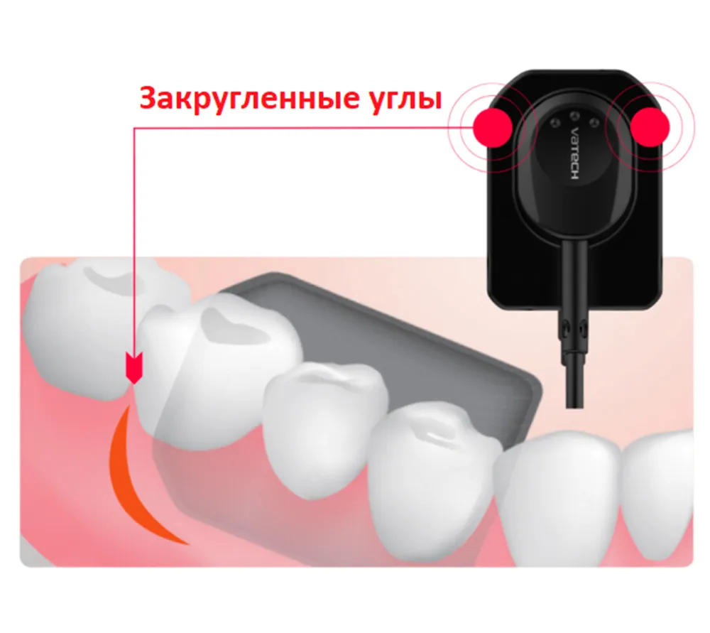 Vatech EzSensor Classic цифровой интраоральный радиовизиограф  3
