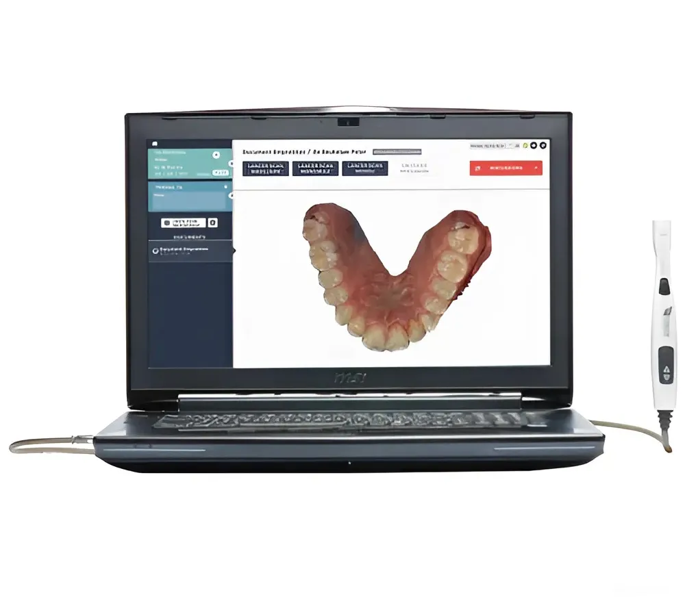 condor интраоральный сканер, ноутбук в комплекте  2