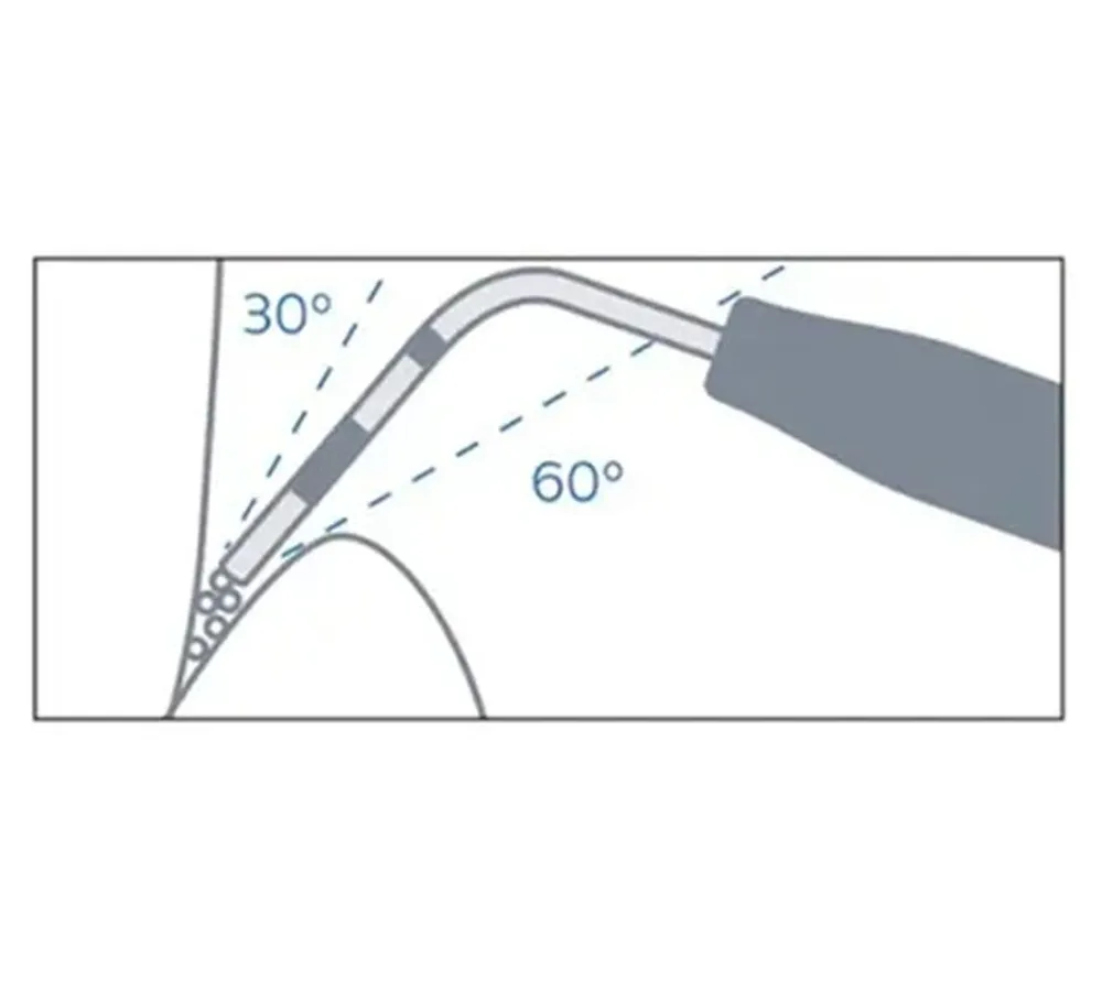 kavo prophyflex 4 perio kit набор для удаления поддесневых отложений  2