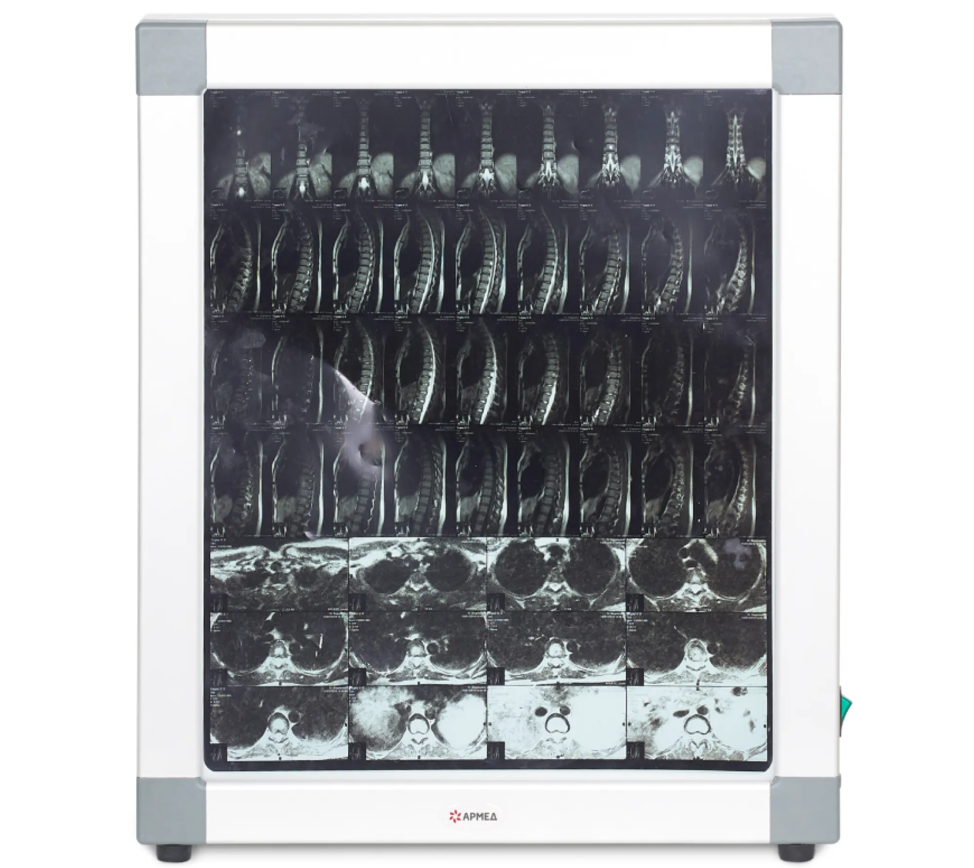 Армед Armed 1-кадровый негатоскоп общего назначения  3