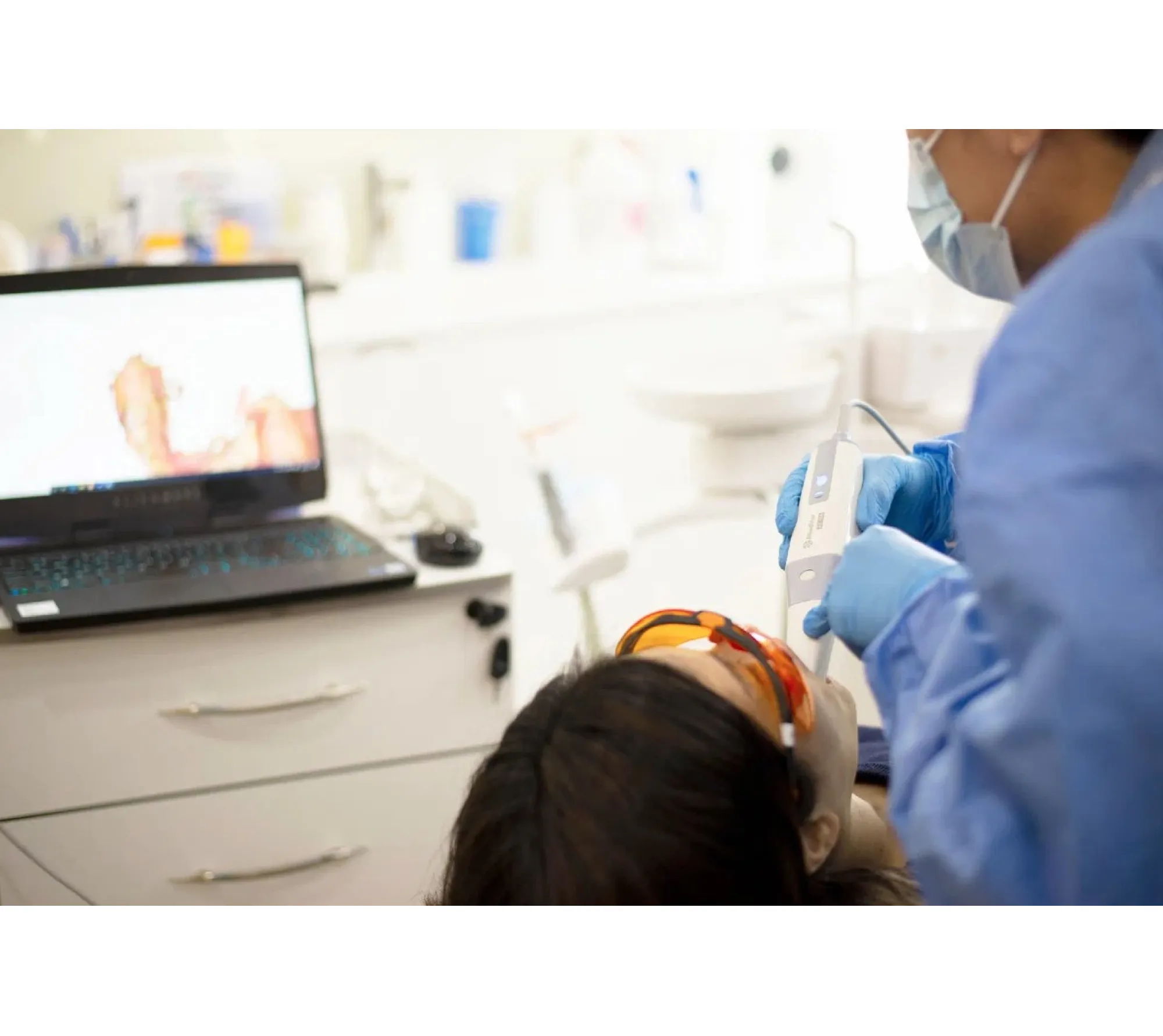 alliedstar as 100 pictures интраоральный 3d сканер  9